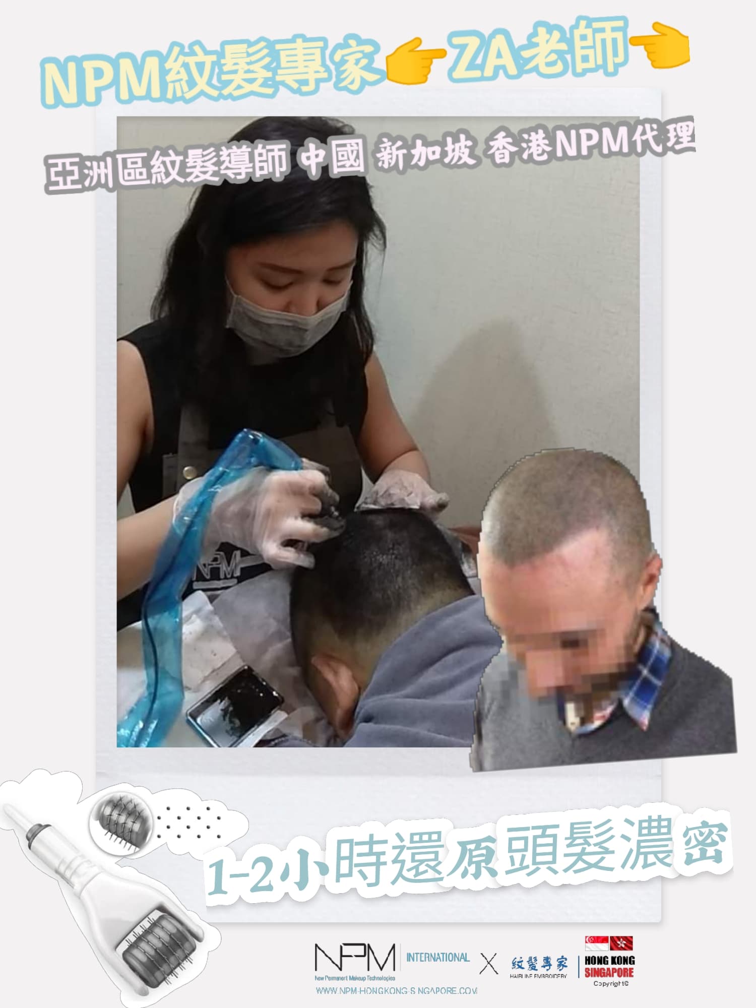 NPM紋髮專家 SMP紋髮 紋髮際線 紋髮線 香港紋髮 