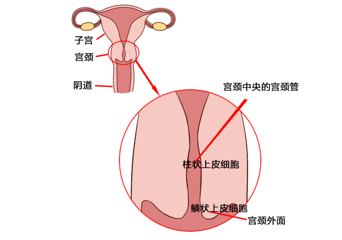 女生別再被騙了：關於「宮頸糜爛」到底是哪爛了？需要治嗎？