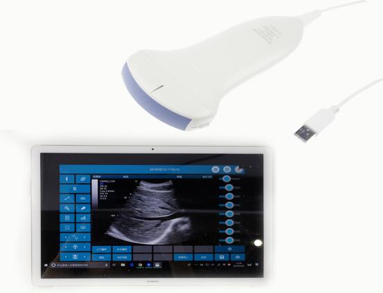 128-elements-convex-2d-portable-android-ultrasound system 
