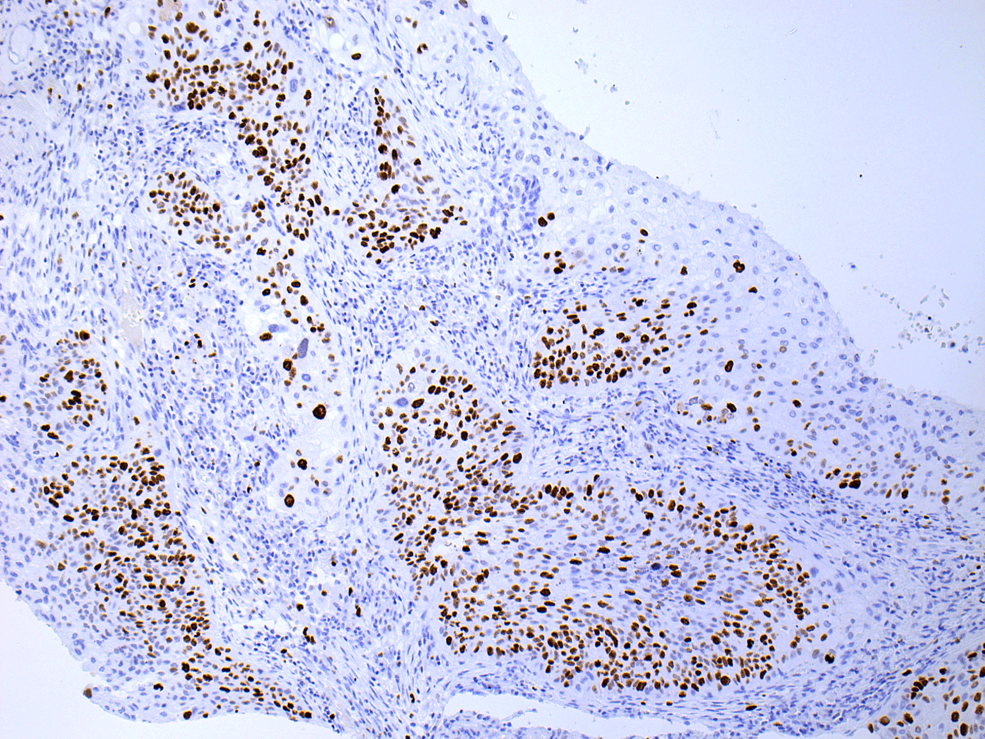 Streptavidin Conjugated Poly Hrp Wuhan Andigensil Biotechnology Co Ltd