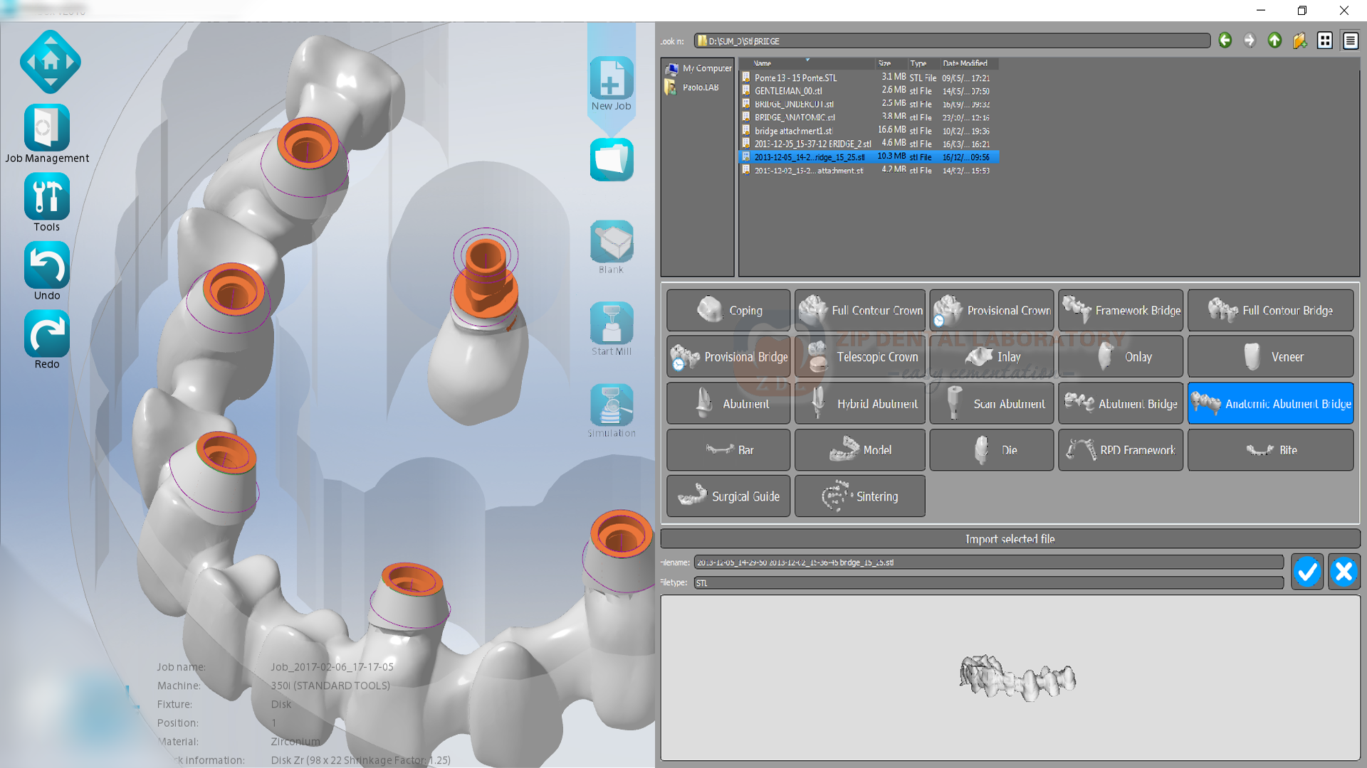 CAD cam стоматология программа