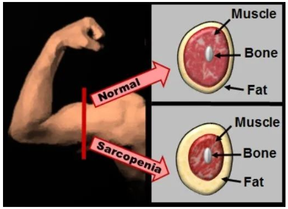 exhilarate! University of Tokyo "longevity drug" NMN human clinical trial: lying flat to increase muscle, reverse the elderly sarcopenia!