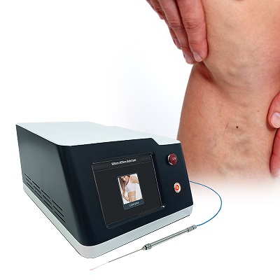 1470nm EVLT Varicose Vein