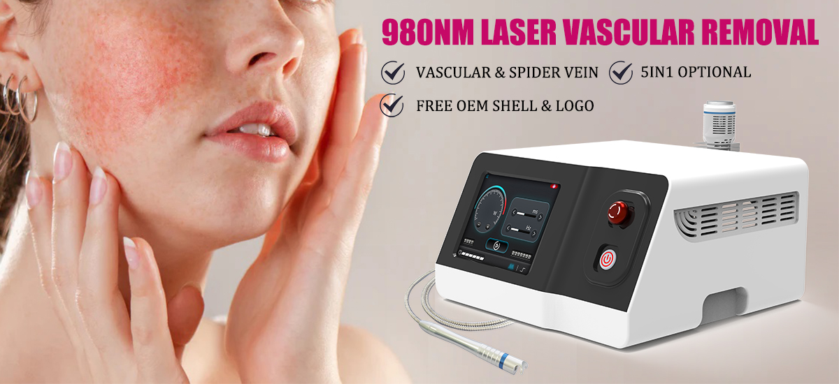 980nm Diode Laser Vascular Removal