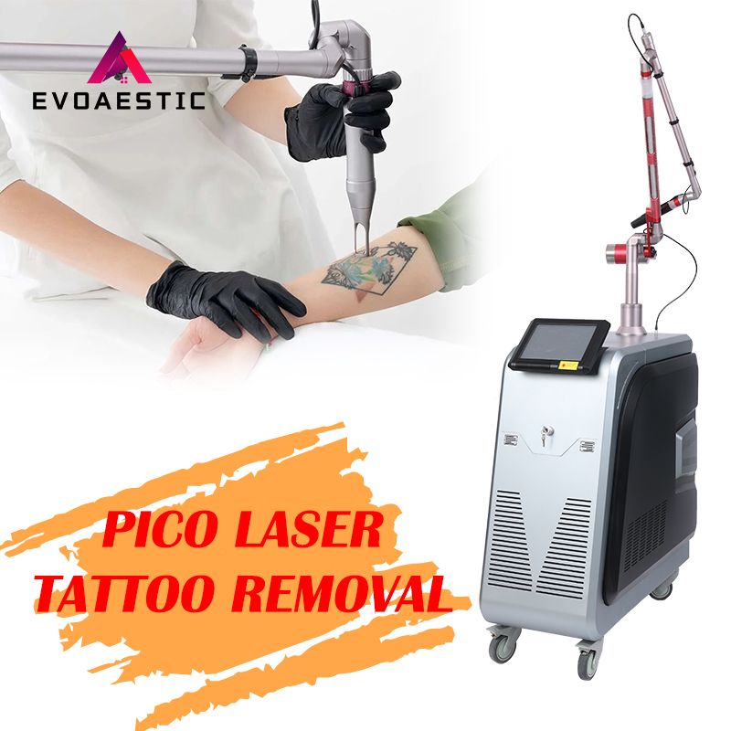 Pico Laser Tattoo Removal