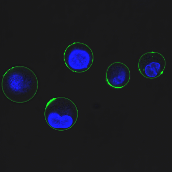  Microfluidic deep immune phenotyping (μDIP)