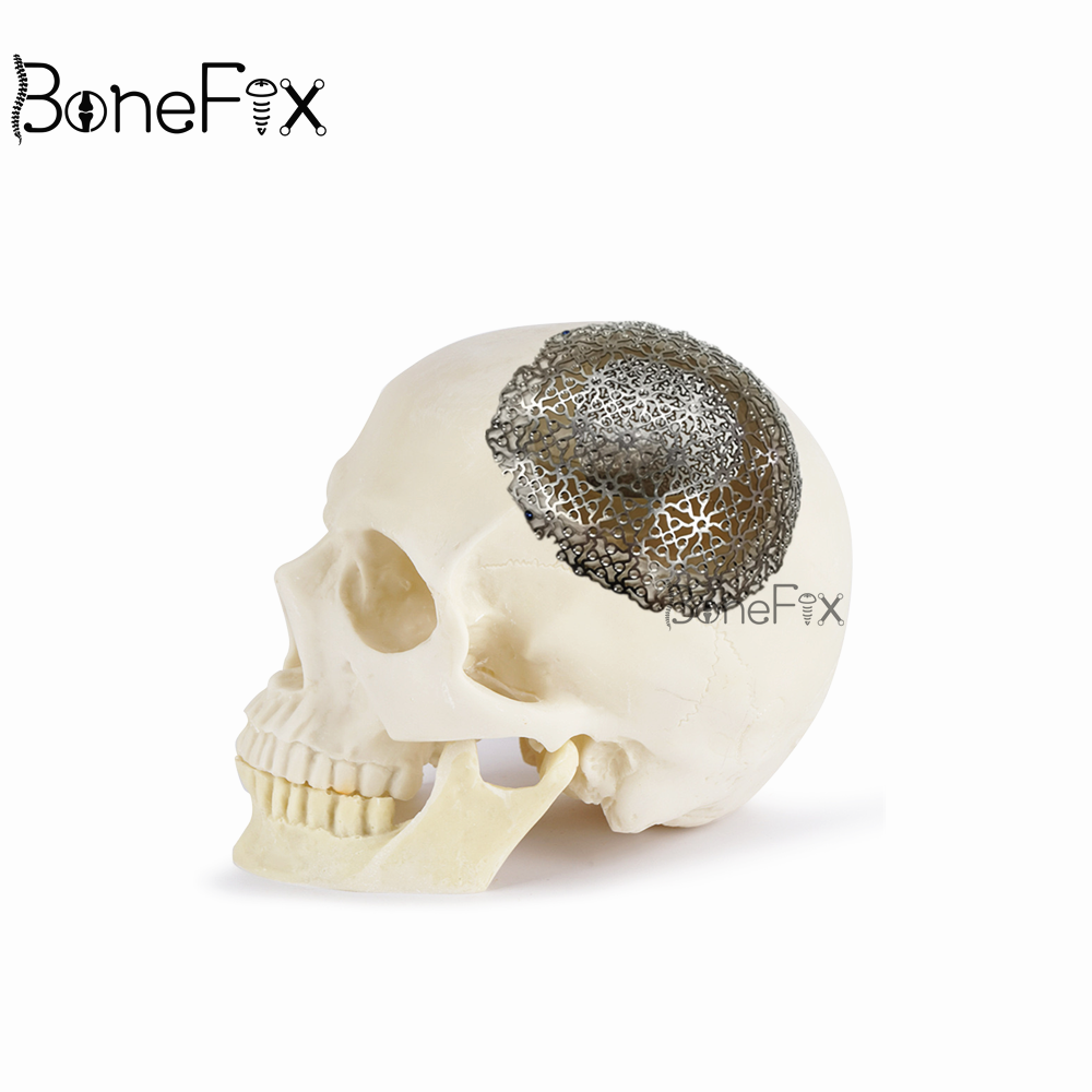 BoneFix- Cranial Im