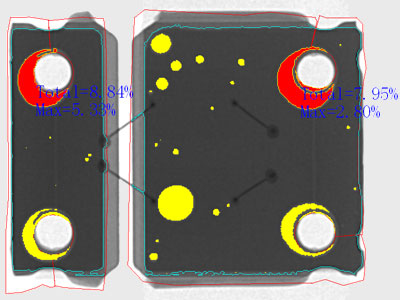 x-ray-FPC-image